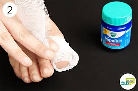 how to get rid of toenail fungus fab how