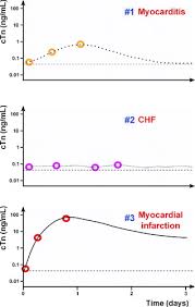 How To Interpret Elevated Cardiac Troponin Levels Circulation