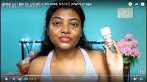 Bio oil for face, bio oil before and after, bio oil review, bio oil for wrinkles, bio oil for stretch marks, bio oil for acne scars, bio oil for. Bio Oil Singapore Our Complete Honest Derma Approved Review