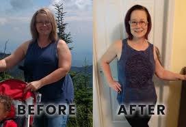 With lipotropic b12 injections chicago, you'll lose weight fast. Women And Weight Loss Karen S 55lbs Weight Loss Story Clarksvillenow Com