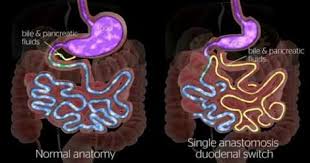 Pin On Get To Know Wakemed Bsnc Surgerync