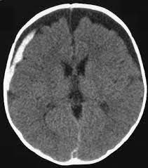 Radiology In Ped Emerg Med Vol 5 Case 7