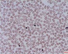 Red blood cell animal definition. Nucleated Red Blood Cell Wikipedia