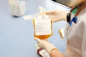 Image result for Plasma Transfusion