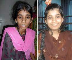 It mainly affects the lungs, but it can affect any part of the body. Bantra St Thomas Home Welfare Society Ppm Project