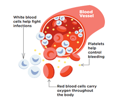 Bone marrow cancer is a form of cancer that starts in the spongy tissue the marrow inside your bones. What Is A Bone Marrow Transplant Be The Match