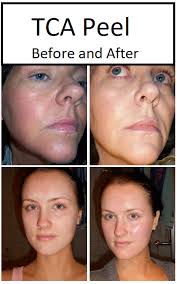 Pin On Skincare