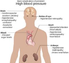 As with systolic and diastolic blood pressure, certain ranges for map are generally considered to be normal or healthy. Blood Pressure Wikipedia