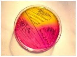 Prueba Agar Manitol Salado La fermentación de manitol indicada por el  cambio de color del indicador rojo fenol, fac… | Medio de cultivo,  Bacteriologia, Fermentación