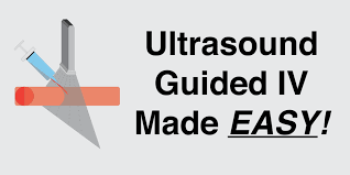 Image result for Peripheral IV Access