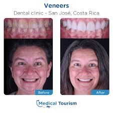 Testimonios Del Cirujano Dentista En San Jose