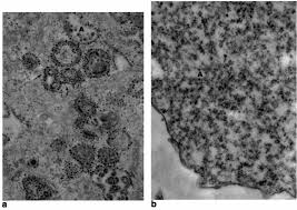 239,580 likes · 596 talking about this. Tem Of Bhk 21 Cells Transfected With S420y A Or K391 B Rna Cell Download Scientific Diagram
