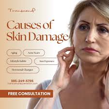 Is your skin telling a story of acne scars, aging, or sun damage? It's time  for a fresh chapter! ✨ At Transcend, we specialize in transforming skin by  tackling everything from hormonal