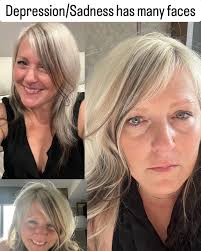 Depression is like a virus which affects the soul. To fight depression you  must conquer your fears, build your confidence and lift your self esteem.  You are special.❤️