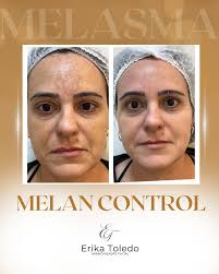 Dra. Erika Camargo de Toledo