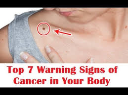 It is important to know the seven warning signs of cancer so that you can have a chance to identify the disease quickly if it does occur in you or a loved one. Top 7 Warnings Signs Of Cancer In Your Body Early Symptoms Of Cancer Detection Youtube