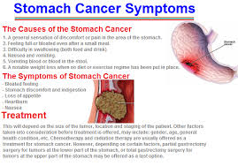 The early signs of stomach cancer. Stomach Cancer Symptoms Causes Diagnosis And Treatment Menstrualcrampss