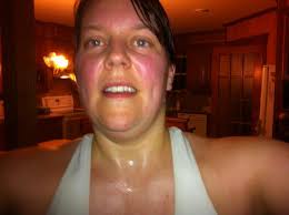 Warning: graphic day 4 recovery update