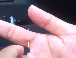 You'll know if you haven't gotten it all because the area will remain sensitive to the touch, trager. 11 Hacks On How To Remove A Splinter Survival Hax