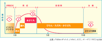 口唇ヘルペスとは 症状の変化 口唇ヘルペスの再発治療薬 アクチビア軟膏