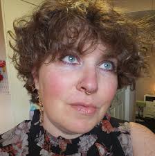 Acupuncture options in Vulcan, Alberta for tinnitus relief?