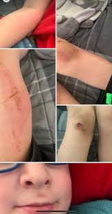 Treadmill safety with children