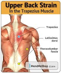 And they're so common they're the second leading complaint doctors hear — after headaches. Muscle Strain Information And Treatments