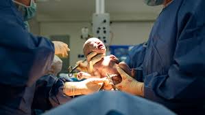 Wenn sonst keine komplikationen oder ähnliches vorliegen versucht man die babys so lange wie möglich im bauch zu halten, um anpassungsschwierigkeiten zu vermeiden. Geplanter Kaiserschnitt Kein Grund Zum Schamen