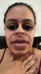 Metodo Para Saltar Selfie En App Nubank