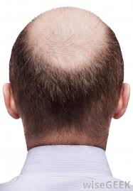 Widows peak hairstyles with low fade look cool on thick dark hair with a gentle transition from the cut to the massive beard through this fade. What Are Hair Growth Patterns With Pictures