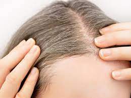 Therefore if you have grey hairs (and even if you colour it) be mindful your hair could be deficient in moisture. 5 Foods That Can Actually Help Prevent Gray Hair Cooking Light