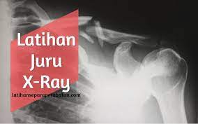 Latihan separa perubatan, antara salah satu latihan yang disediakan oleh pihak spa bagi mereka yang ingin berkhidmat di bawah kementerian kesihatan malaysia (kmm). Latihan Juru X Ray Latihan Separa Perubatan