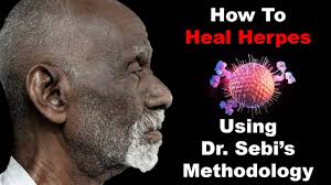 There was no significant difference between. How To Heal Herpes Using Dr Sebi S Methodology Youtube