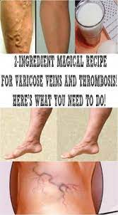 Vicks Vaporub Uses For Varicose Veins Mentholatum
