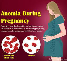 We did not find results for: Komplikasi Kurang Darah Waktu Mengandung Ketahui 7 Gejala Anemia Tasneem Naturel