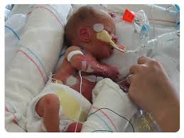 Fruhgeburt Und Fruhchen Mamiweb De