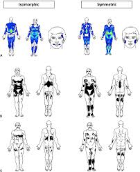 Questions from the trail guide to the body student workbook; Skin Mapping For The Classification Of Generalized Morphea Journal Of The American Academy Of Dermatology