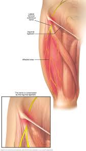 It is part of the lower limb. Meralgia Paresthetica Symptoms And Causes Mayo Clinic