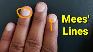 Image result for Mees Line