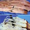 Convert splint to hand based dorsal block splint. 1