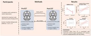 Image result for Moderate Flow Oxygen