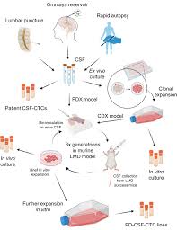 Image result for CSF Culture