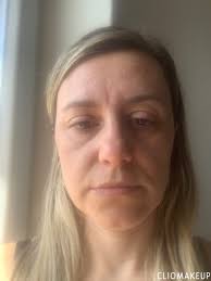 Il Face Taping funziona davvero? Quali sono i benefici? Il TeamClio l'ha  provato per voi