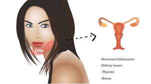 Pimples On Chin Meaning How To Get Rid Of Break Out On Chin Face Mapping Acne Pimples On Chin Face Mapping