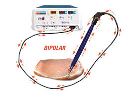 Monopolar Electrosurgery Vs Bipolar Electrosurgery Bovie Medical