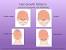 Male Types Of Hair Growth Patterns