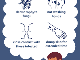 Both products can kill lice quickly, sometimes in one go. Ringworm Causes And Risk Factors