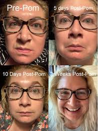 Pomifera 101 | Tuesday Tip! When A 💋 Just Won'T Do. Pomifera Rose Oil -  The Boo Boo Healer. Kid Tested- Mom Approved! | Facebook