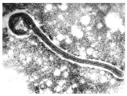Marburg virus is one of 2 viruses belonging to the filovirus family. Viruses Free Full Text Forty Five Years Of Marburg Virus Research Html
