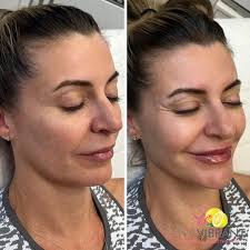 LiveVibrant Wellness & Aesthetics